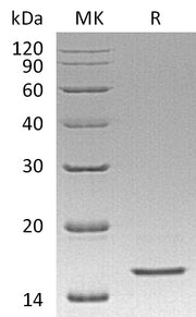 Recombinant Human REG4 (C-6His)