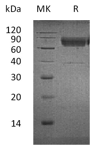 Recombinant Human CD300a (C-Fc-6His)