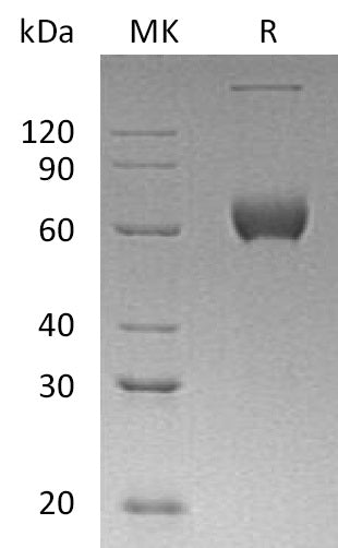 Recombinant Human ESAM (C-Fc)