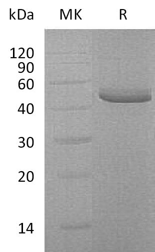 Recombinant Human TRAIL R2 (C-Fc-6His)