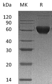 Recombinant Human ACVR2B (C-Fc-6His)