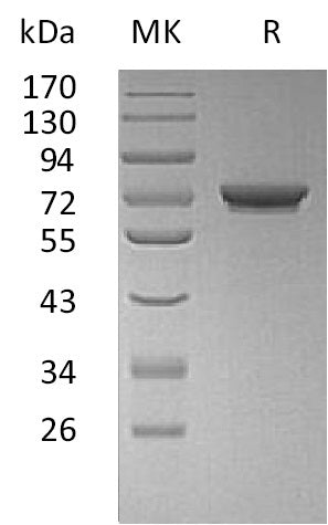 Recombinant Human GALNT7 (C-6His)