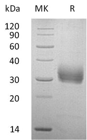 Recombinant Human SOST (C-6His)