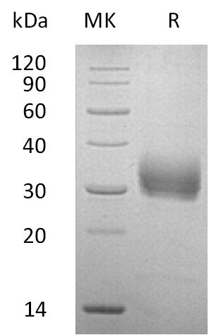 Recombinant Human SOST (C-6His)