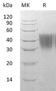 Recombinant Human AGP2 (C-6His)