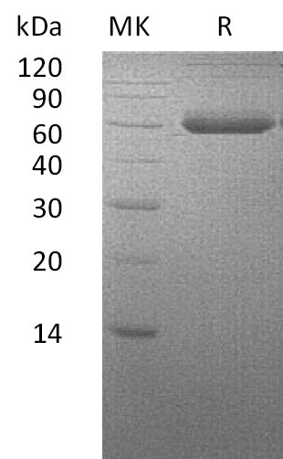 Recombinant Human BMPR1A (C-Fc-6His)