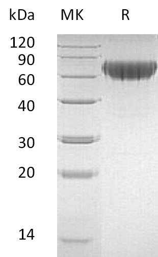 Recombinant Human CD27 (C-Fc-6His)