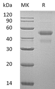 Recombinant Human ERp44 (C-6His)