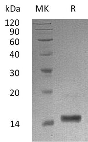 Recombinant Human LALBA (C-6His)