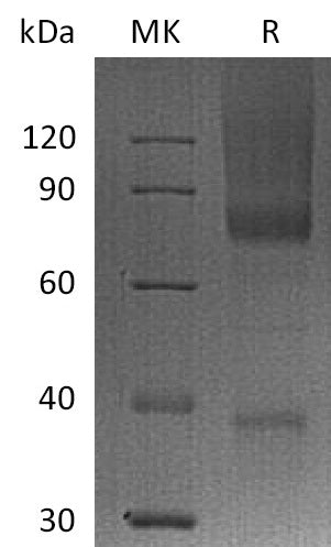 Biotinylated Human GPC3 (C-6His-Avi)