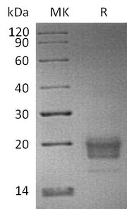 Biotinylated Human TIGIT (C-6His-Avi)