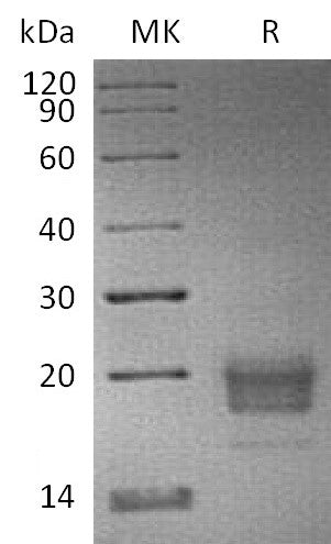 Biotinylated Human TIGIT (C-6His-Avi)