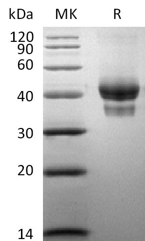 Biotinylated Human BCMA (C-Fc-Avi)