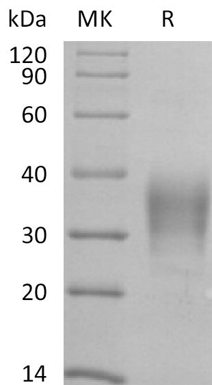 Biotinylated Human CD79B (C-6His-Avi)