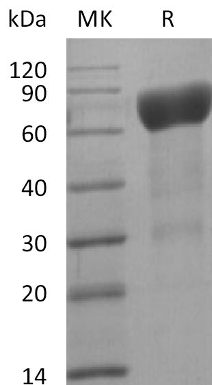 Biotinylated Human IL-6RA (C-Avi-6His)