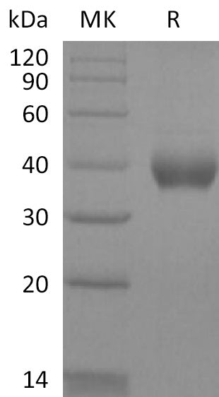Biotinylated Human IL-2RB (C-6His-Avi)