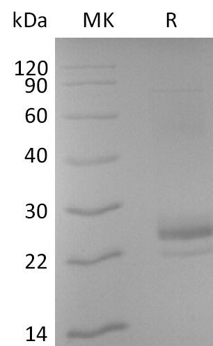 Biotinylated Human CD40L (N-6His-Avi)