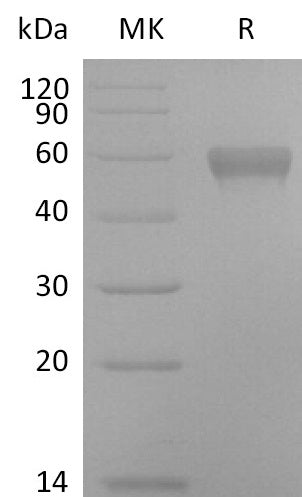 Biotinylated Human NTNG1 (C-Avi-6His)