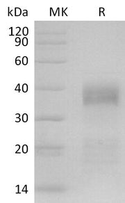 Biotinylated Human IGFBP-5 (C-6His-Avi)