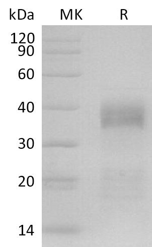Biotinylated Human IGFBP-5 (C-6His-Avi)