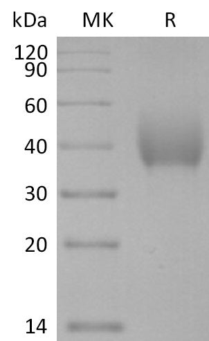 Biotinylated Human SLAMF7 (C-6His-Avi)