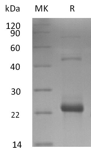 Biotinylated Human IL-17C (C-6His-Avi)