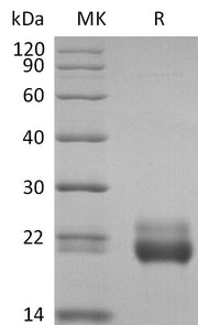 Biotinylated Human TRAIL R2 (C-Avi-6His)