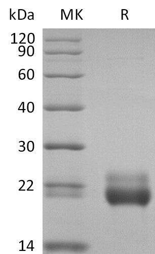 Biotinylated Human TRAIL R2 (C-Avi-6His)