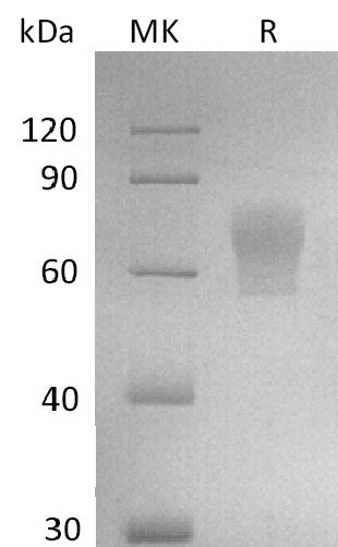 Biotinylated Human MAdCAM-1 (C-Avi-6His)