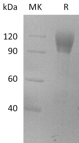 Biotinylated Human VCAM-1 (C-Avi-6His)