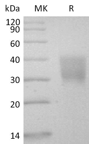 Biotinylated Human CD147 (C-Avi-6His)