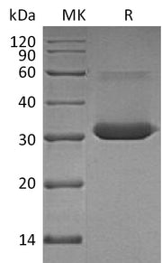 Recombinant Human IgG4 Fc (224AA)