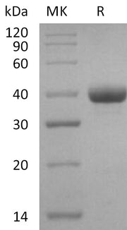 Recombinant Human IgG3 Fc
