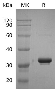 Recombinant Human IgG2 Fc (228AA)