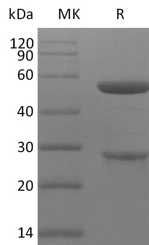 Anti-Human MASP-2 Antibody (NAR_bio, Research Grade)