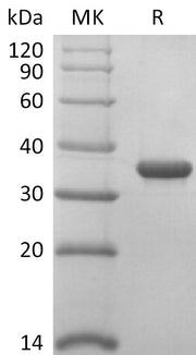 Recombinant 2019-nCoV Papain-Like Protease