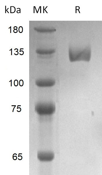 Recombinant Human PSMA (N-Fc)
