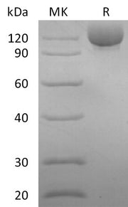 Recombinant Human CD117 (C-Fc)