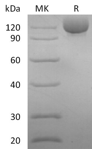 Recombinant Human CD117 (C-Fc)