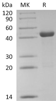 Recombinant Human PPM1A (C-6His)