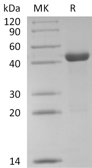 Recombinant Human PPM1A (C-6His)