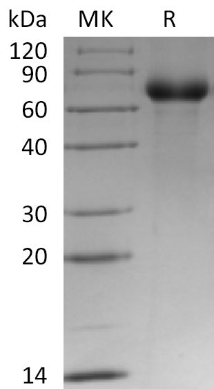 Recombinant Human LRP12 (C-6His)