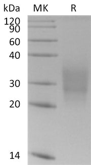 Recombinant Human CD300a (C-6His)