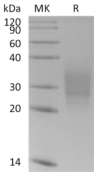 Recombinant Human CD300a (C-6His)