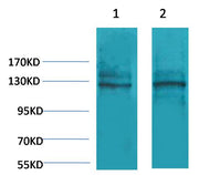 Calcium Sensing Receptor Rabbit pAb