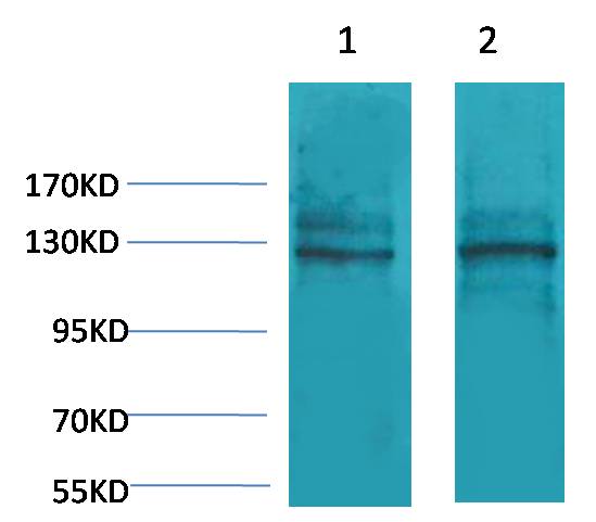 Calcium Sensing Receptor Rabbit pAb