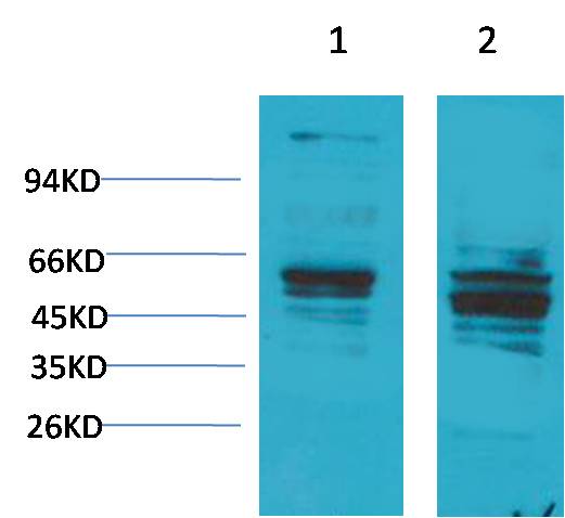 Bombesin Receptor 2 Rabbit pAb
