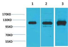 CaVα2δ2 Rabbit pAb