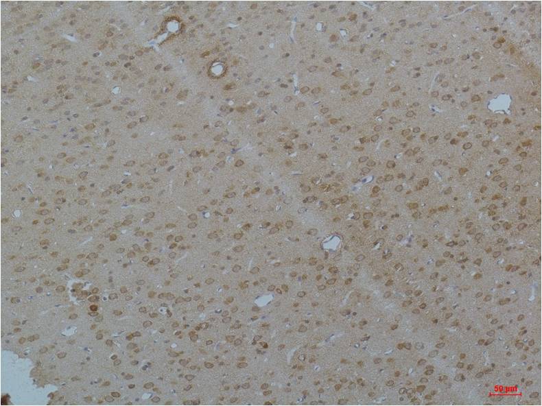 Cav pan α1 Rabbit pAb