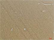 GABA B Receptor 2 Rabbit pAb